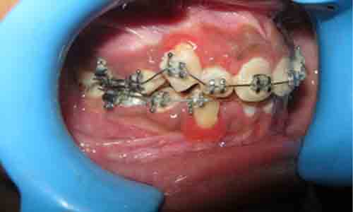Dental Oral Surgery in India